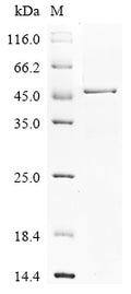 (Tris-Glycine gel) Discontinuous SDS-PAGE (reduced) with 5% enrichment gel and 15% separation gel.