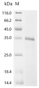 (Tris-Glycine gel) Discontinuous SDS-PAGE (reduced) with 5% enrichment gel and 15% separation gel.