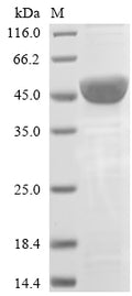 (Tris-Glycine gel) Discontinuous SDS-PAGE (reduced) with 5% enrichment gel and 15% separation gel.
