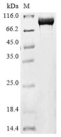 (Tris-Glycine gel) Discontinuous SDS-PAGE (reduced) with 5% enrichment gel and 15% separation gel.