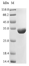 (Tris-Glycine gel) Discontinuous SDS-PAGE (reduced) with 5% enrichment gel and 15% separation gel.