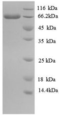 Recombinant Escherichia coli Long-chain-fatty-acid--CoA ligase (fadD) – Figure 1 of 1