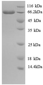 Recombinant Escherichia coli Long-chain-fatty-acid--CoA ligase (fadD) – Figure 1 of 1