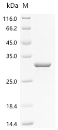 (Tris-Glycine gel) Discontinuous SDS-PAGE (reduced) with 5% enrichment gel and 15% separation gel.