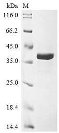 (Tris-Glycine gel) Discontinuous SDS-PAGE (reduced) with 5% enrichment gel and 15% separation gel.