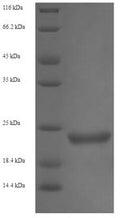 Recombinant Enterobacteria phage H19B Shiga-like toxin 1 subunit B (stxB) – Figure 1 of 1