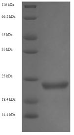 Recombinant Enterobacteria phage H19B Shiga-like toxin 1 subunit B (stxB) – Figure 1 of 1