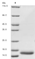 (Tris-Glycine gel) Discontinuous SDS-PAGE (reduced) with 5% enrichment gel and 15% separation gel.