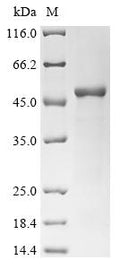(Tris-Glycine gel) Discontinuous SDS-PAGE (reduced) with 5% enrichment gel and 15% separation gel.