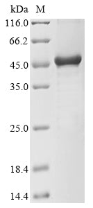 (Tris-Glycine gel) Discontinuous SDS-PAGE (reduced) with 5% enrichment gel and 15% separation gel.