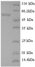 Recombinant Escherichia coli Glutamate decarboxylase alpha (gadA) – Figure 1 of 1