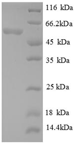 Recombinant Escherichia coli Glutamate decarboxylase alpha (gadA) – Figure 1 of 1