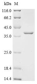 (Tris-Glycine gel) Discontinuous SDS-PAGE (reduced) with 5% enrichment gel and 15% separation gel.