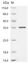 (Tris-Glycine gel) Discontinuous SDS-PAGE (reduced) with 5% enrichment gel and 15% separation gel.
