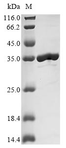 (Tris-Glycine gel) Discontinuous SDS-PAGE (reduced) with 5% enrichment gel and 15% separation gel.