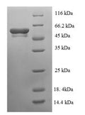 Recombinant Escherichia coli Glutamate-pyruvate aminotransferase AlaC (alaC) – Figure 1 of 1