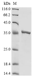 (Tris-Glycine gel) Discontinuous SDS-PAGE (reduced) with 5% enrichment gel and 15% separation gel.