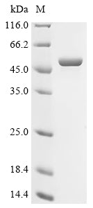 (Tris-Glycine gel) Discontinuous SDS-PAGE (reduced) with 5% enrichment gel and 15% separation gel.