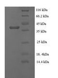Recombinant Rabies virus Phosphoprotein (P) – Figure 1 of 1