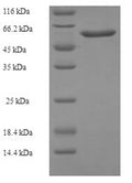 Recombinant Escherichia coli Ribonucleoside-diphosphate reductase 1 subunit beta (nrdB) – Figure 1 of 1