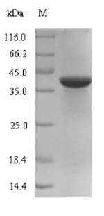(Tris-Glycine gel) Discontinuous SDS-PAGE (reduced) with 5% enrichment gel and 15% separation gel.