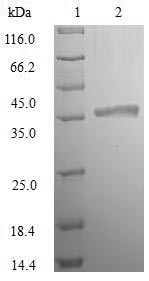 (Tris-Glycine gel) Discontinuous SDS-PAGE (reduced) with 5% enrichment gel and 15% separation gel.