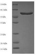 Recombinant Escherichia coli Cell division protein ZipA (zipA) – Figure 1 of 1