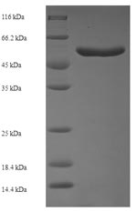 Recombinant Escherichia coli Cell division protein ZipA (zipA) – Figure 1 of 1