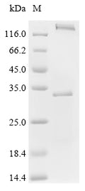 (Tris-Glycine gel) Discontinuous SDS-PAGE (reduced) with 5% enrichment gel and 15% separation gel.