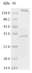 (Tris-Glycine gel) Discontinuous SDS-PAGE (reduced) with 5% enrichment gel and 15% separation gel.