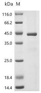 (Tris-Glycine gel) Discontinuous SDS-PAGE (reduced) with 5% enrichment gel and 15% separation gel.