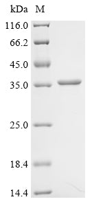 (Tris-Glycine gel) Discontinuous SDS-PAGE (reduced) with 5% enrichment gel and 15% separation gel.