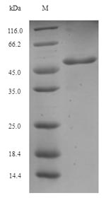 (Tris-Glycine gel) Discontinuous SDS-PAGE (reduced) with 5% enrichment gel and 15% separation gel.