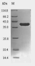 (Tris-Glycine gel) Discontinuous SDS-PAGE (reduced) with 5% enrichment gel and 15% separation gel.