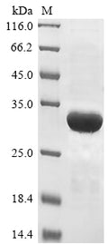 (Tris-Glycine gel) Discontinuous SDS-PAGE (reduced) with 5% enrichment gel and 15% separation gel.