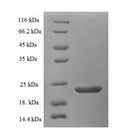 (Tris-Glycine gel) Discontinuous SDS-PAGE (reduced) with 5% enrichment gel and 15% separation gel.