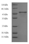 (Tris-Glycine gel) Discontinuous SDS-PAGE (reduced) with 5% enrichment gel and 15% separation gel.