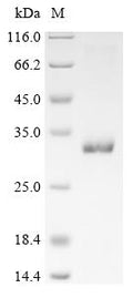 (Tris-Glycine gel) Discontinuous SDS-PAGE (reduced) with 5% enrichment gel and 15% separation gel.