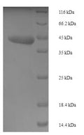 (Tris-Glycine gel) Discontinuous SDS-PAGE (reduced) with 5% enrichment gel and 15% separation gel.