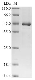 (Tris-Glycine gel) Discontinuous SDS-PAGE (reduced) with 5% enrichment gel and 15% separation gel.