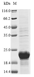 (Tris-Glycine gel) Discontinuous SDS-PAGE (reduced) with 5% enrichment gel and 15% separation gel.