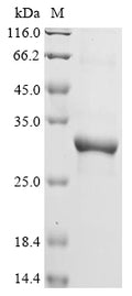 (Tris-Glycine gel) Discontinuous SDS-PAGE (reduced) with 5% enrichment gel and 15% separation gel.