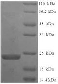 Recombinant Bauhinia ungulata Factor Xa inhibitor BuXI (BuXI) – Figure 1 of 1