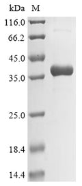 (Tris-Glycine gel) Discontinuous SDS-PAGE (reduced) with 5% enrichment gel and 15% separation gel.