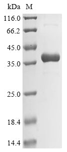 (Tris-Glycine gel) Discontinuous SDS-PAGE (reduced) with 5% enrichment gel and 15% separation gel.