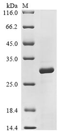 (Tris-Glycine gel) Discontinuous SDS-PAGE (reduced) with 5% enrichment gel and 15% separation gel.