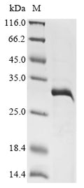 (Tris-Glycine gel) Discontinuous SDS-PAGE (reduced) with 5% enrichment gel and 15% separation gel.