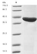 (Tris-Glycine gel) Discontinuous SDS-PAGE (reduced) with 5% enrichment gel and 15% separation gel.