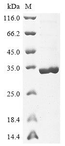 (Tris-Glycine gel) Discontinuous SDS-PAGE (reduced) with 5% enrichment gel and 15% separation gel.