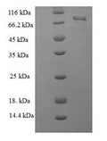 Recombinant Helicobacter pylori Glutamate--tRNA ligase 1 (gltX1) – Figure 1 of 1